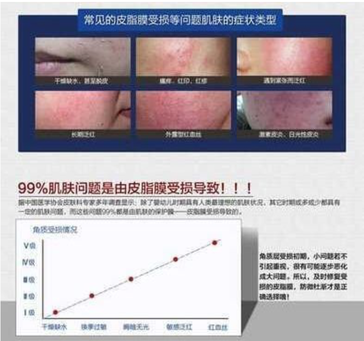 為什么你的臉容易過敏？