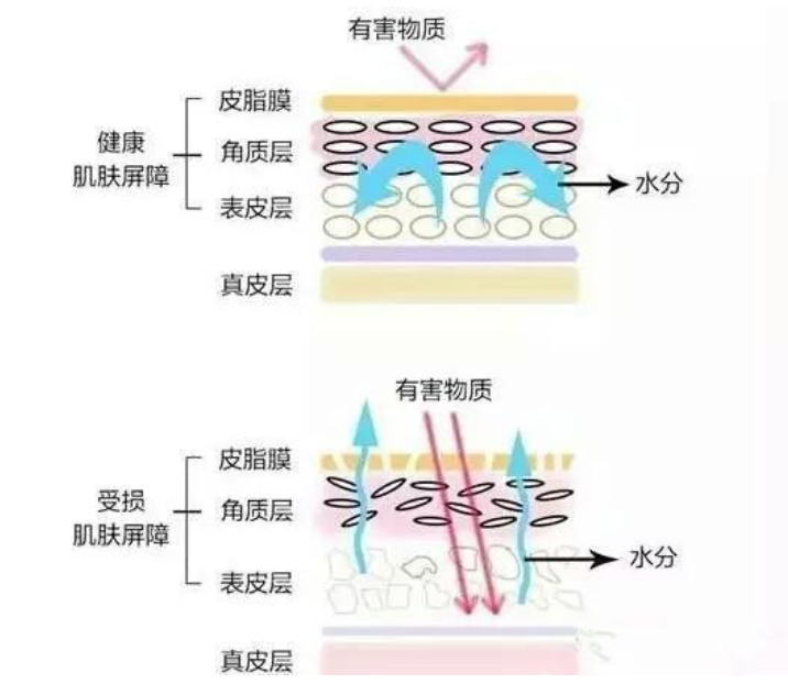 干、癢、紅、腫？別慌涂護(hù)膚品，先看看皮膚屏